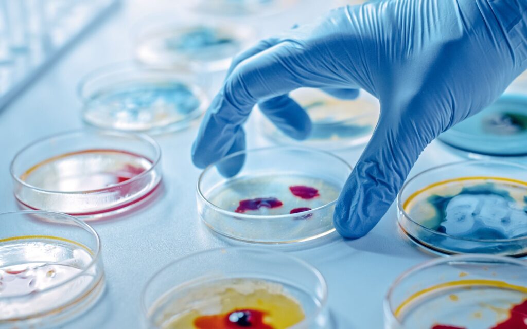 PHD Medical Microbiology in Legon Admission Requirements 2024/2025